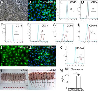 Human Amniotic Epithelial Stem Cell-Derived Retinal Pigment Epithelium Cells Repair Retinal Degeneration